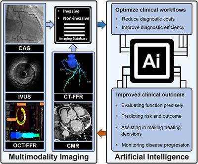Artificial Intelligence—A Good Assistant to Multi-Modality Imaging in Managing Acute Coronary Syndrome